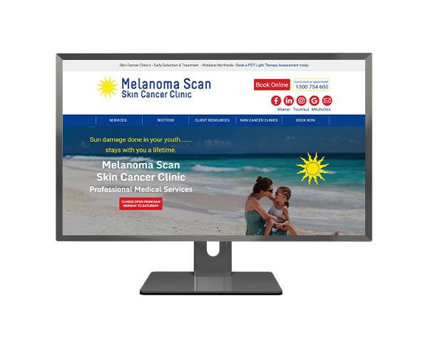 Melanoma Scan Joomla Portfolio